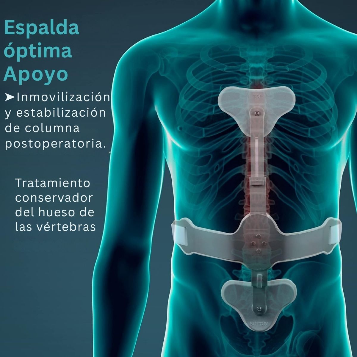 Soporte Hiperextencion Tynor Tipo Cash Ortopedico Columna